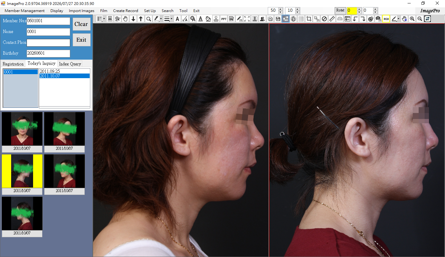  Step 2. image folder selection