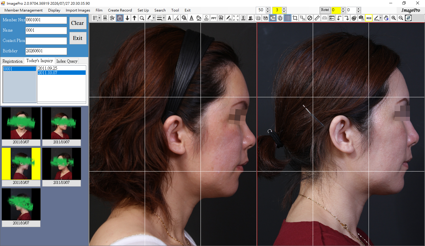  Step 3. image comparison screen 